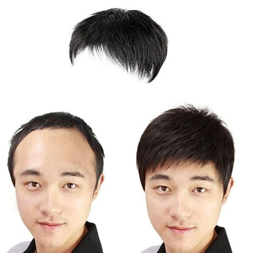 SK Storea Guitara Top Cover Men's Vertex Hair(Medium) O-Type Alopecia (KYR-WBD729E)684185
