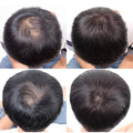 SellyBit Global SFr Men's Vertex O-Shaped Hair Loss Cover Wig (33490102)